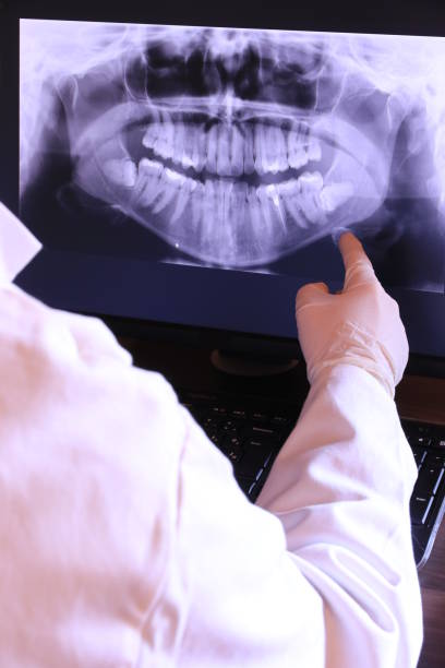 Best Emergency Treatment for Toothache in Lyndonville, VT