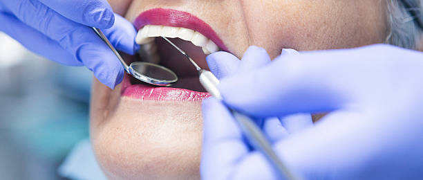 Best Emergency Tooth Extraction in Lyndonville, VT